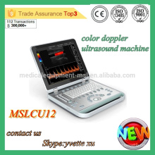 MSLCU12M Máquina de ultrasonido Protable 3D Máquina de ultrasonido Dopple color Escáner de ultrasonido barato protable